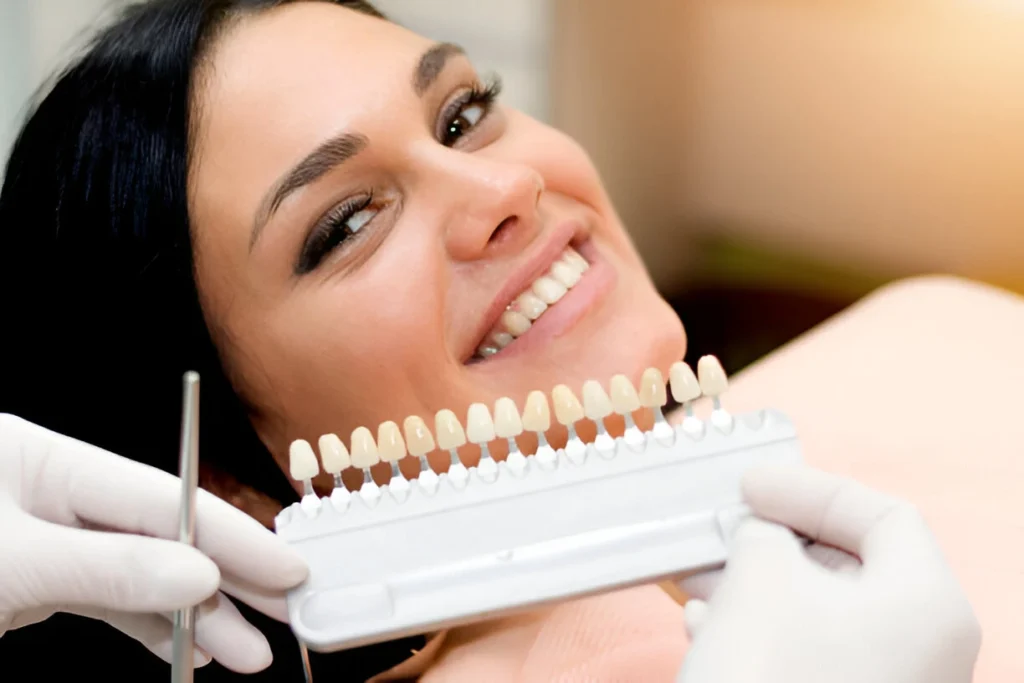 dental veneers medowie