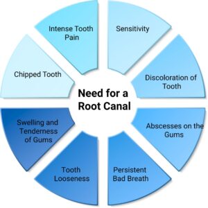 Why You Need Root Canal